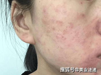 肌肤|水光语|为什么我已经认真护肤了，皮肤却还不见好转？