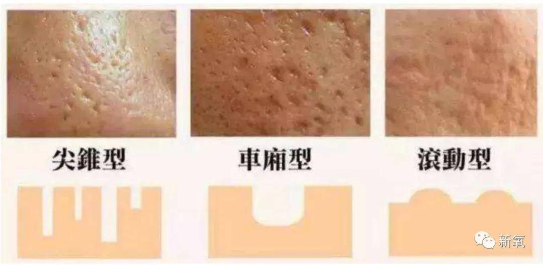 皮肤|16岁就上春晚的顶级流量，现在这脸怎么长残成这样了...
