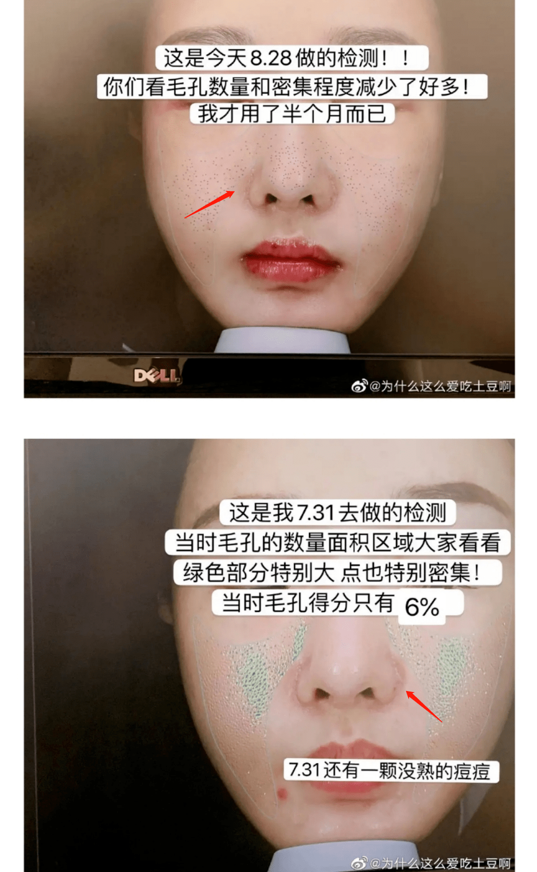 土豆|自己整成馒头脸,还教粉丝瞎整,她这不是第一次翻车了…