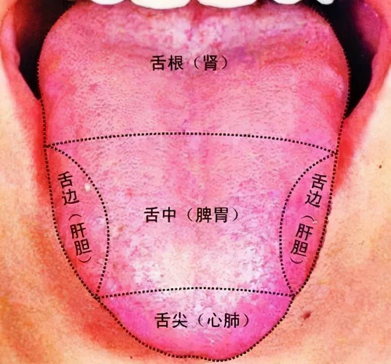 舌尖红是心火上炎;舌边红为肝胆有热;红而干为热伤津液或阴虚火旺.