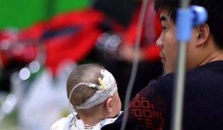 因为|给宝宝输液为何要把针扎在头上？或许是因为这些情况