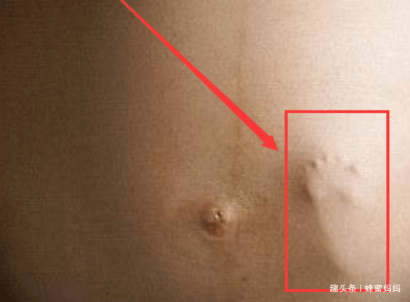 反应|恭喜你，你家宝宝“智商超高”在孕期要是有这3种“特殊反应”