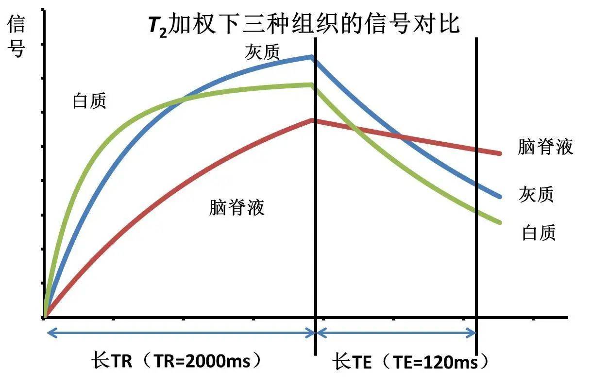 用实例分析磁共振加权成像