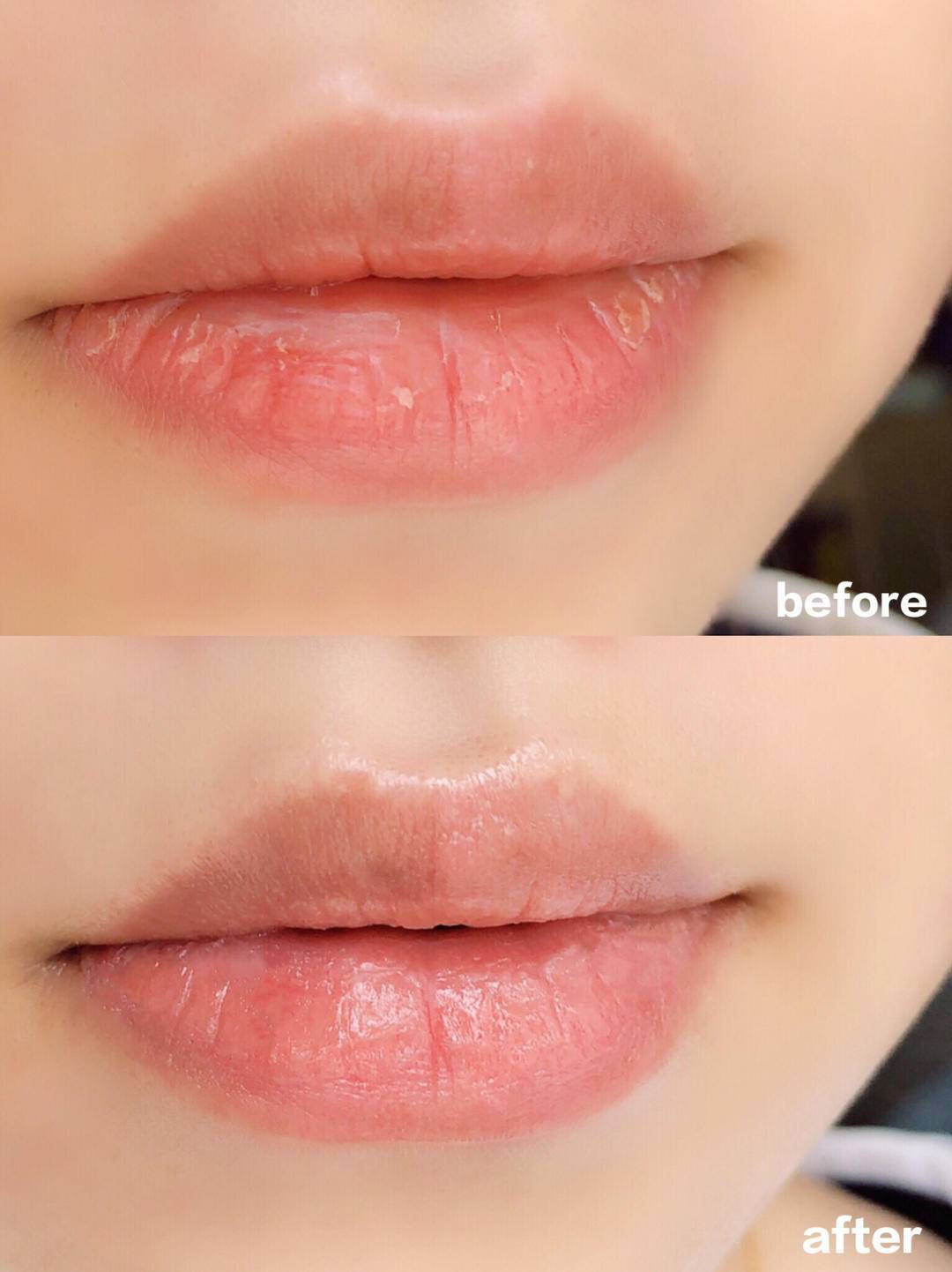 嘴唇|一进秋天,嘴巴比脸还干!用了它,男朋友整天捧着我的嘴亲