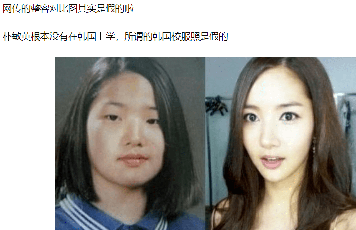 朴敏英|9年换5次头，do得毫无痕迹，双眼皮竟然还都是亲爸割的...