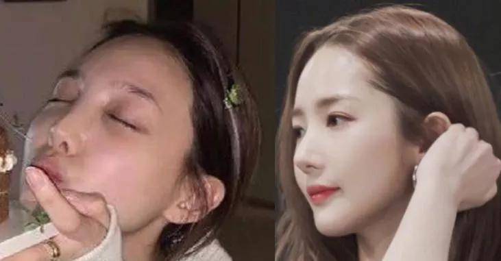 朴敏英|9年换5次头，do得毫无痕迹，双眼皮竟然还都是亲爸割的...