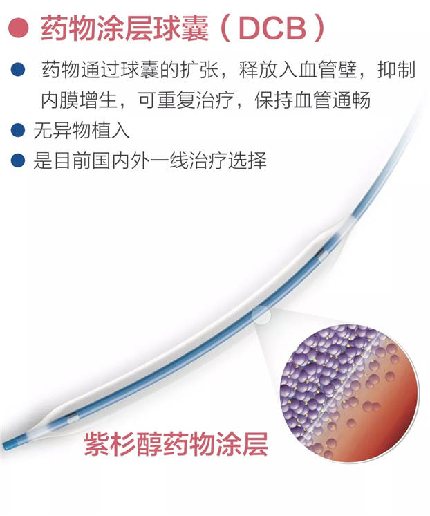 疾病|广安门医院举办“周围血管疾病义诊宣传日”系列活动