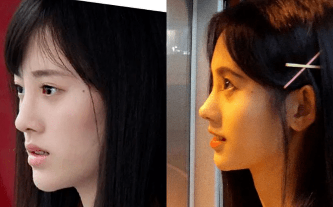 赵丽颖|鞠婧祎和赵丽颖竟然是同一个医生？