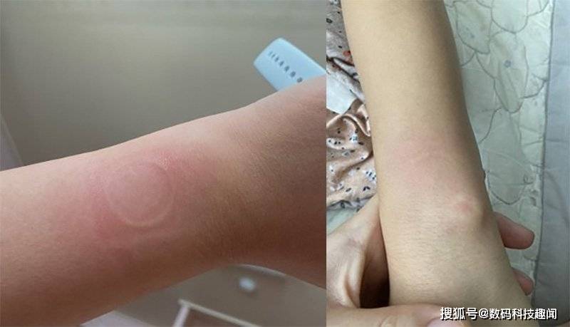 Apple Watch SE�û����ֱ�������������,��ĻҲ������