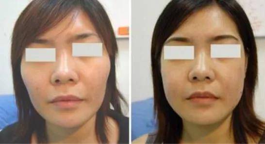 李惠利|女明星最绝大鼻头变身记！娜扎do鼻子前应该找她取经1000次...