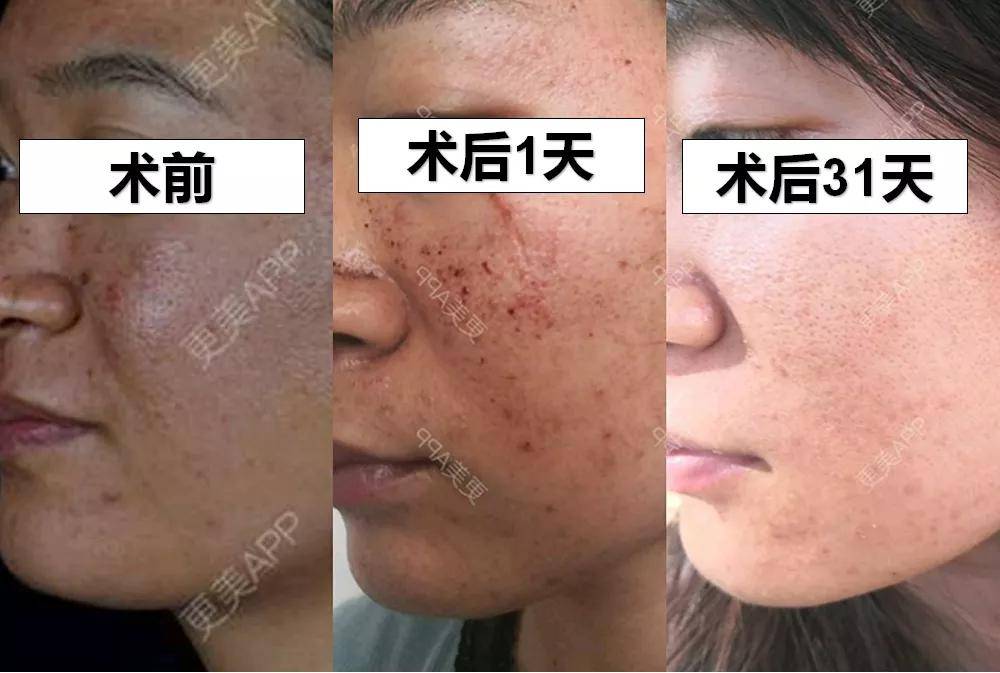 毛孔|权志龙，你真的不能再整了啊...