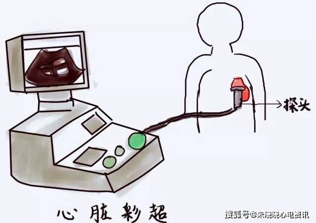 心脏彩超心电图和心脏造影有什么不一样