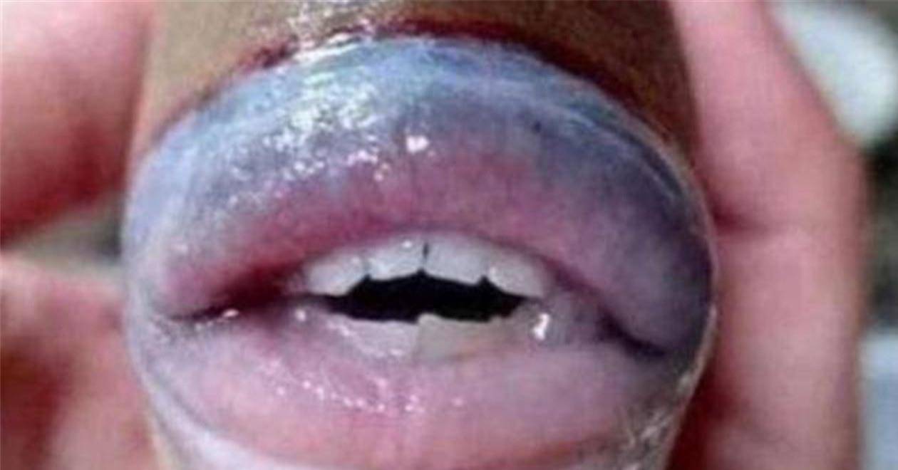 疯狂猜成语唇和牙齿_疯狂猜成语的字和箭头(3)