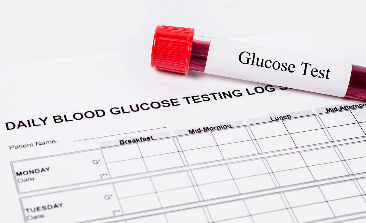 自己怎样测试肝功能 bfb907fab1c04b70a507f27ce9792189.jpeg