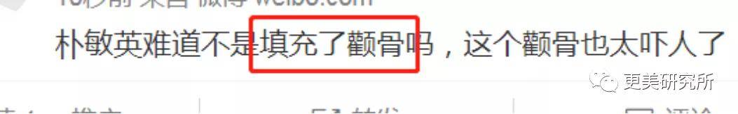 颧骨|返厂N次鼻比金晨还粗，美商在线20年的她怎么了？