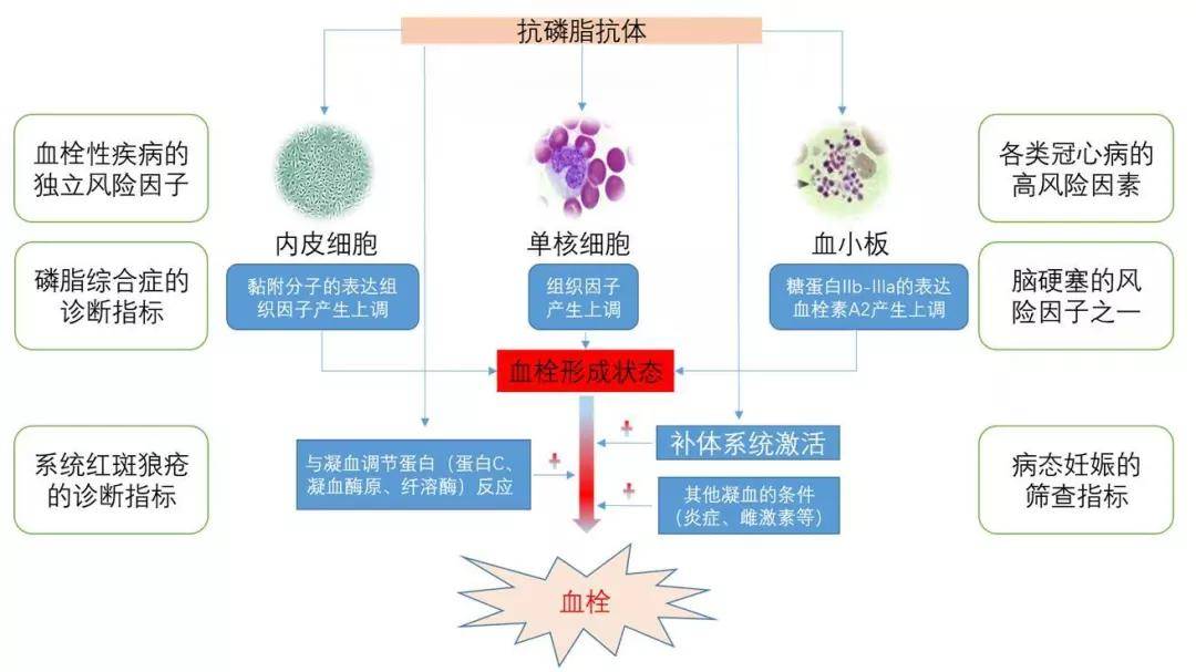 "专敲人家墙壁"的抗体——抗心磷脂抗体与胎停的"恩恩怨怨"