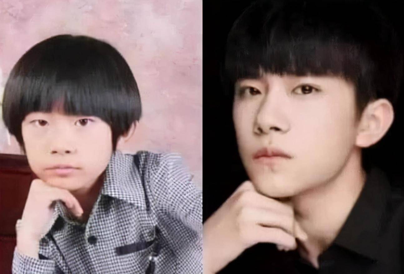 孩子|3个部位越“丑”，长大颜值越高，很少有人三条全中宝刚出生