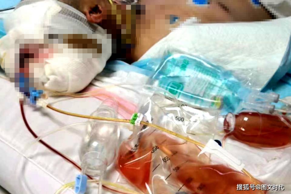 医生|医生束手无策，4个月后醒来那一刻，妈妈哭了14岁少年突然昏迷