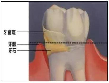 都敢|P图师傍身的杨超越都敢营销艳压热巴了，但生图的脸和嘴都是怎么了？