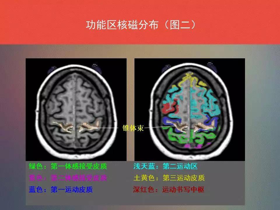 帽状腱膜●9,边缘沟●10,中央后沟●11,中央沟●12,中央后回●13,颞浅