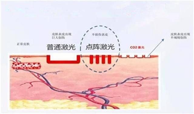 点阵射频的原理是什么_点阵式布局是什么意思(2)