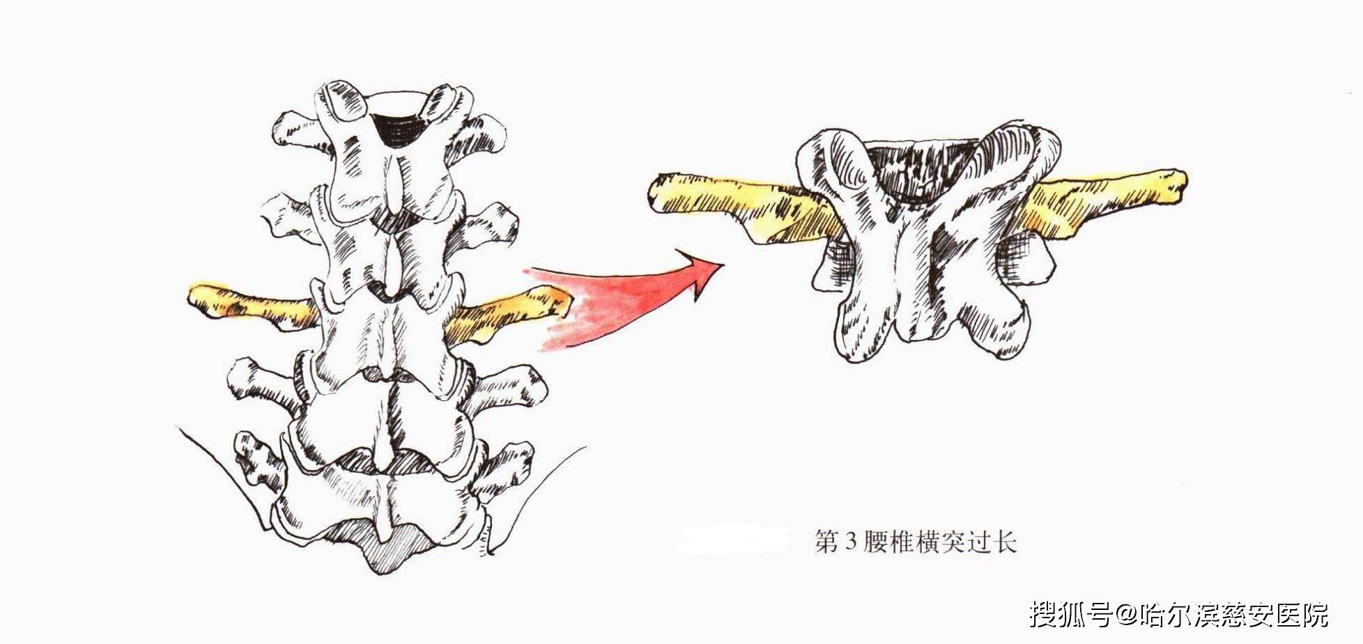 第三节 腰椎的MRI解剖-腰椎疾病比较影像学-医学