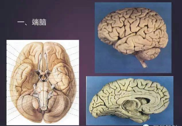 脑由灰质,白质,基底核和脑室等组成.