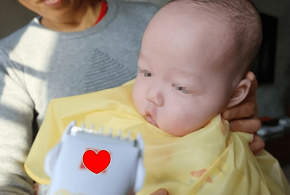 胎毛|新生宝宝胎脂胎毛该咋处理?父母须看“真丑!生了个毛娃娃”