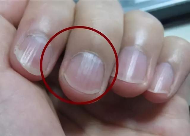 原创为什么很多人指甲上有月牙有的人却一个都没有科学解释来了