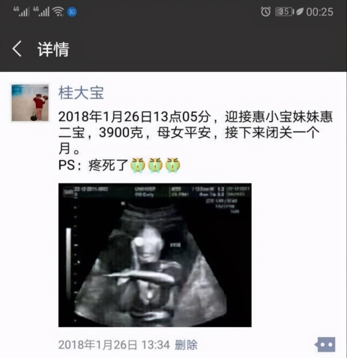 这样不仅将喜讯传达给了朋友,而且还保护了孩子的个人信息,简直一举两