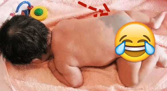 屁股|淘人精？”宝宝屁股“淤青”的秘密，你知道多少？“屁股青