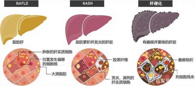 GDP胆碱_中国gdp增长图