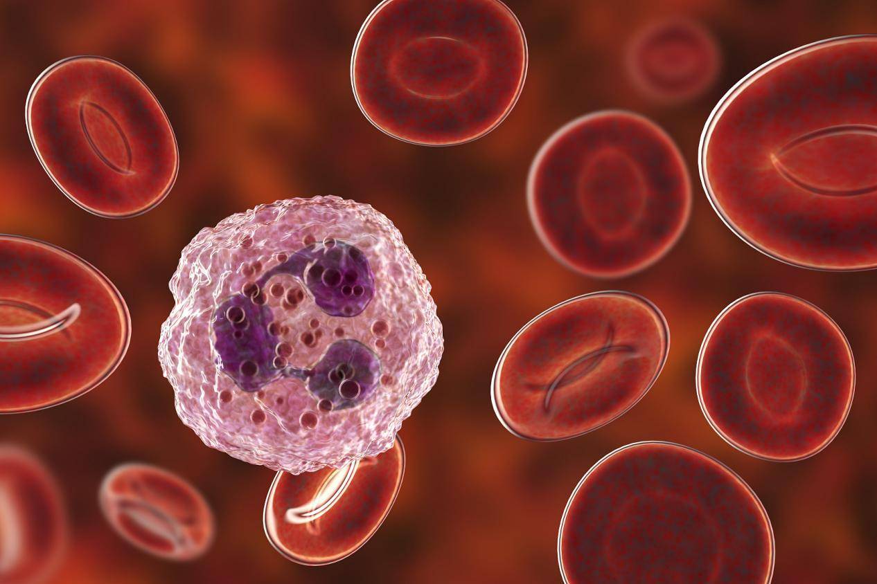 怎么查是否是过敏性鼻炎 46498c2e48af49528b38f00ebd9b9bbb.jpeg
