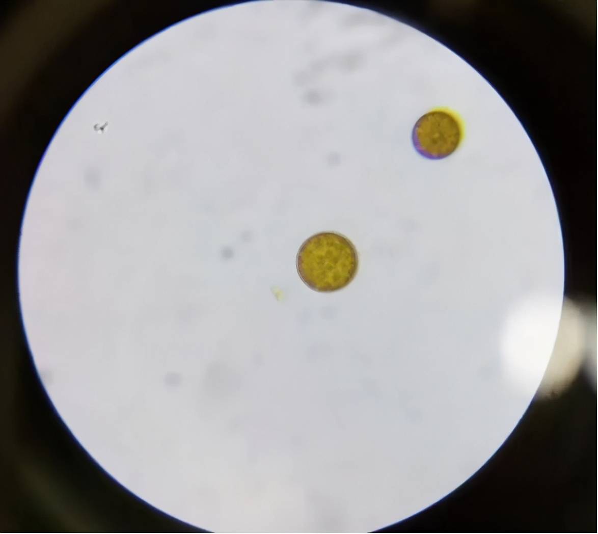 显微镜镜检藻相小环藻