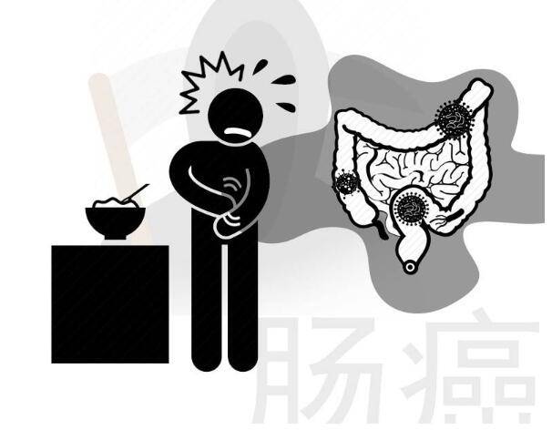 肠癌并非毫无征兆,早期有3个不起眼的症状,容易被忽视