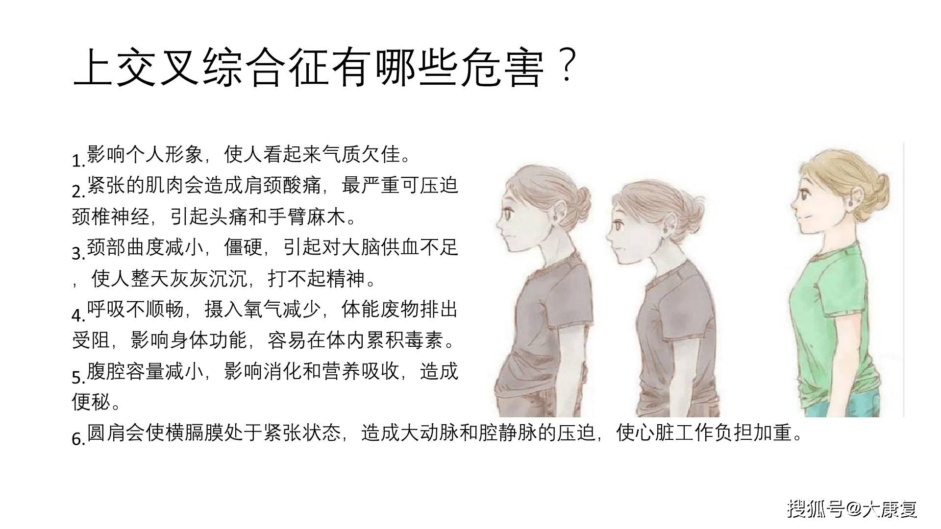 上交叉综合征的肌肉失衡及处理