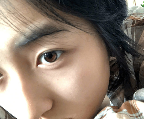 抱脸虫是如何抱脸的 2383794bff4d47fdba5ddb1608d1d672.png