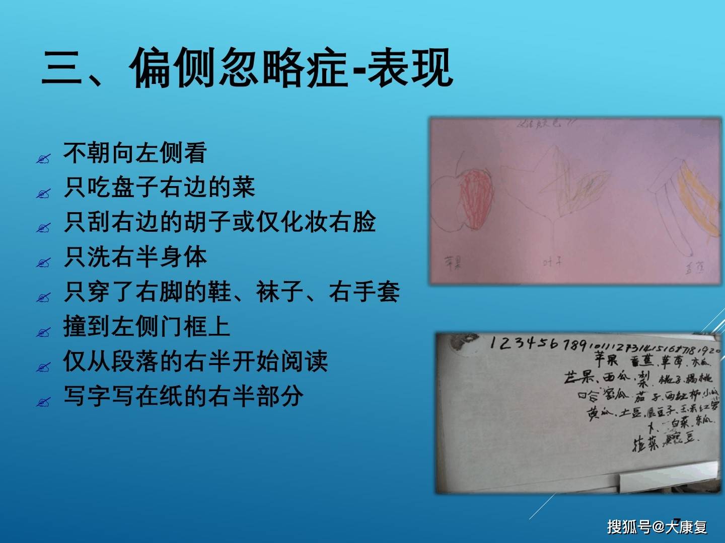 偏侧忽略症的康复治疗