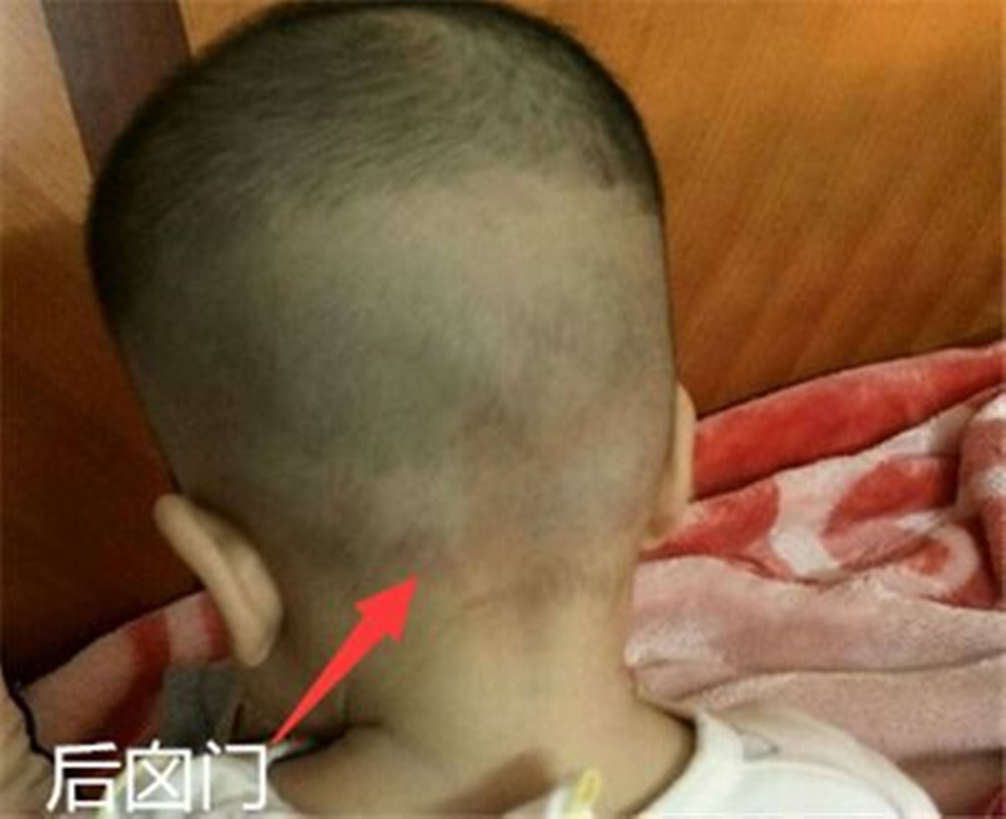 婴儿的囟门不能摸,摸了会