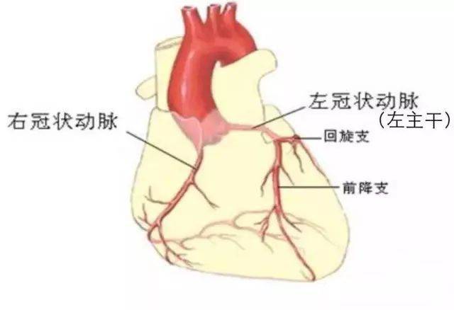 患者因胸闷,胸痛症状来我院检查治疗,冠脉造影显示前降支近段严重狭窄