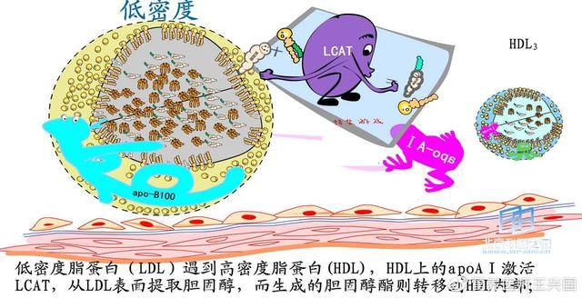 低密度胆固醇和高密度胆固醇高的原因 42e8725f6f3d4f5b8c4a07877e02f975.jpeg