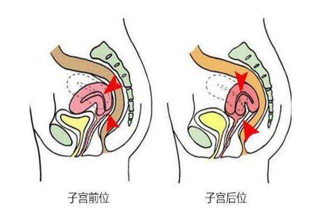 同房后垫高pp真的能提高受孕概率吗这类女性才需要此方法