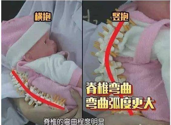 几个月可以做背带 2b23222e0cc047cd9ea5fed54961d8ef.jpeg