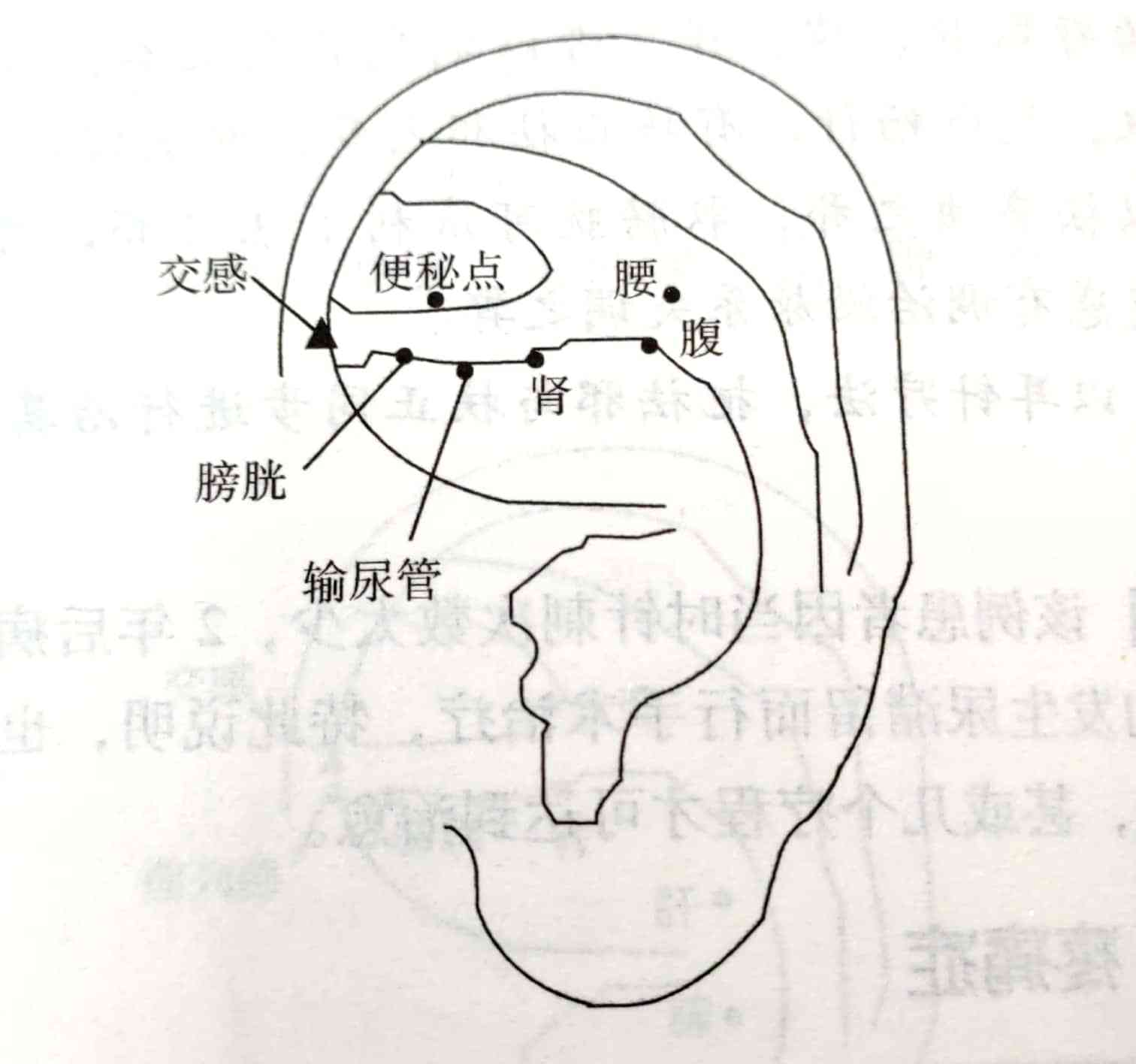 看我如何用耳穴终结肾结石反复发作搬走你通往健康路上的绊脚石