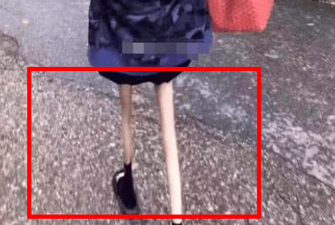 女孩"牙签腿"走红,素颜五官出众,一看双腿就暴露"畸形"审美