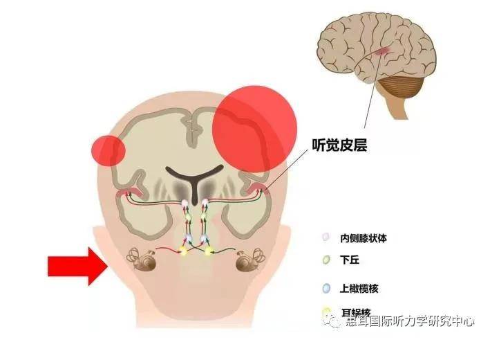 大脑听觉中枢偏侧化发育