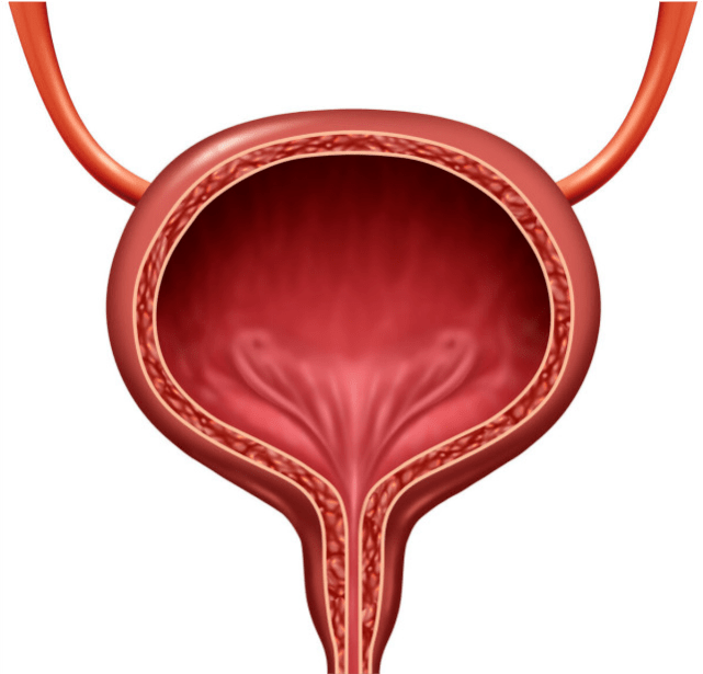2.膀胱结石怎么治疗:膀胱结石怎么治疗