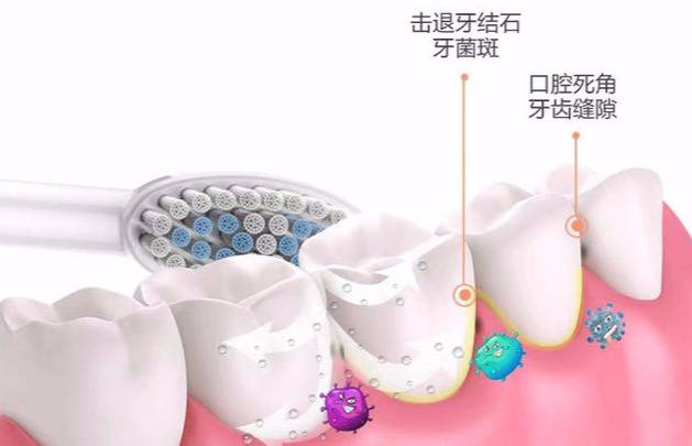 如何刷牙才能让牙齿没有异味 8c0799209a2c4fd19c4b0a8123529c6d.jpeg