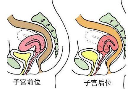 女性的子宫前位,说的是宫颈是向下指,但是阴道后穹窿,处于女性身体内