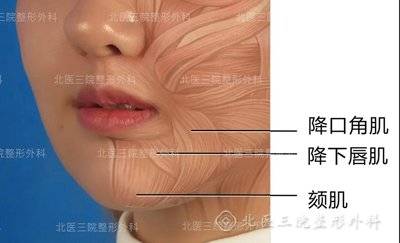 口角两侧肌肉力量不平衡有关,往往是两侧降下唇肌,降口角肌肌力不平衡